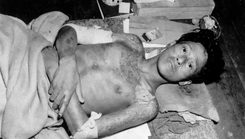 Nagasaki'den Nükleer Tehditlere Dikkat Çeken Uyarı: 80 Yıl Sonra Yeniden