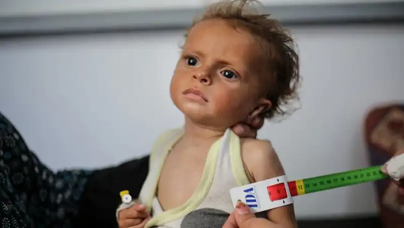İngiltere, 300 Gazzeli Çocuğa Yeni Bir Hayat Sunuyor